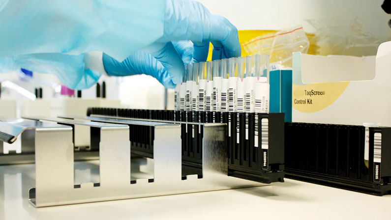 Healthcare-medical-scanning Test tubes with barcodes